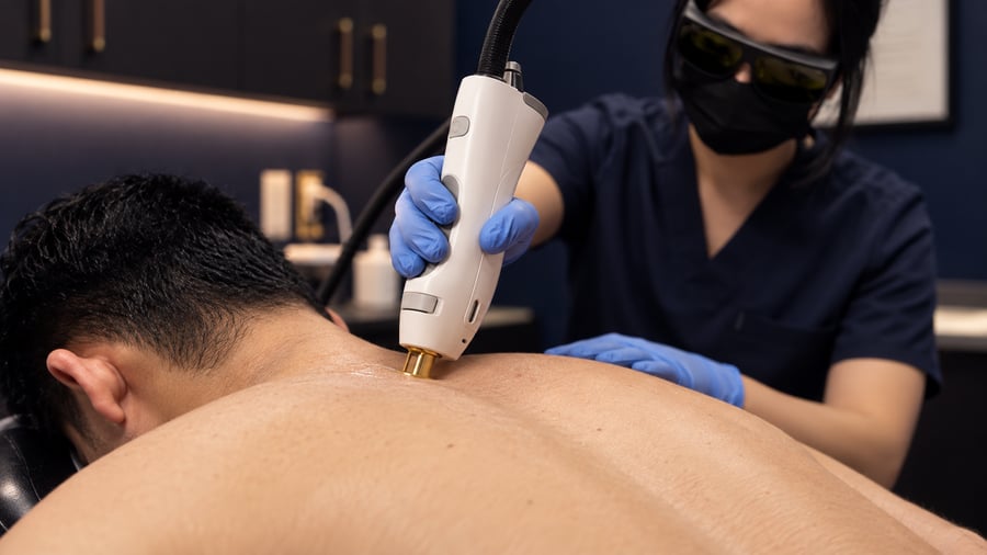Man receiving back laser hair removal with the Candela GentleMax Pro at Flycatcher