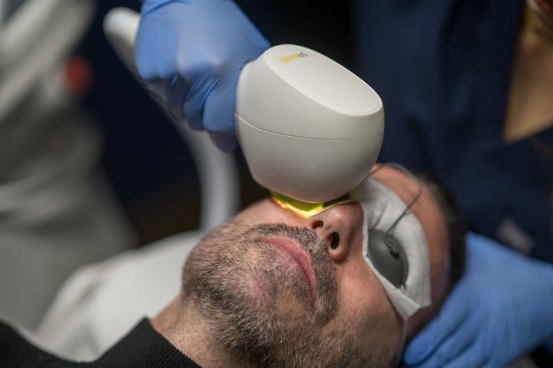 IPL treating sun damage on Austin man