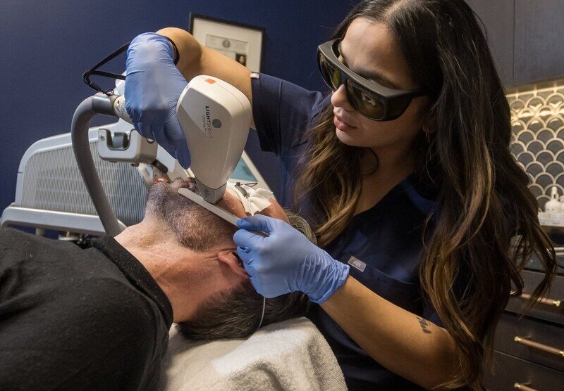 facial hair removal with laser