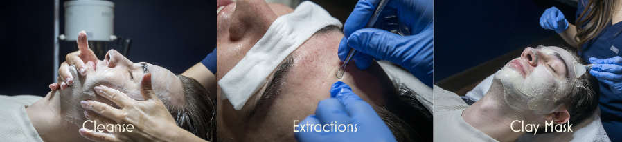 facial and chemical peel protocol at Flycatcher