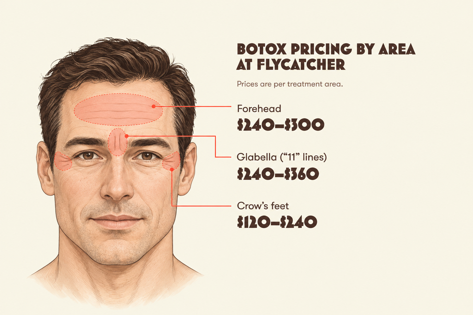Male face illustrating Flycatcher Botox pricing: forehead $240–$300, glabella “11” lines $240–$360, and crow’s feet $120–$240.