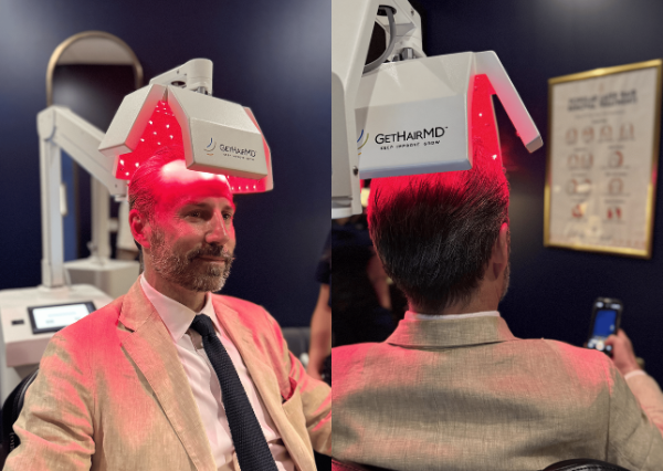 Man receiving low-level laser therapy for hair loss