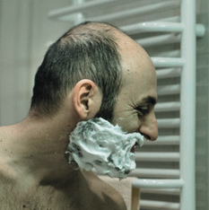 hair loss client