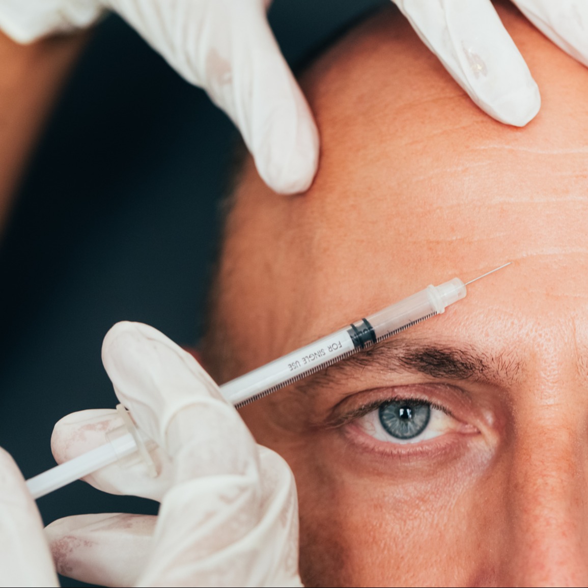 male patient getting botox in forehead